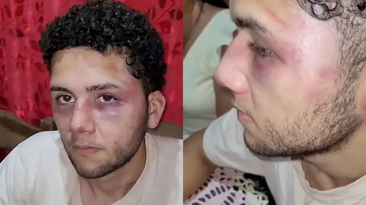 Denuncia de Secuestro y Tortura: Trabajador Revela Violencia Laboral en Venezuela