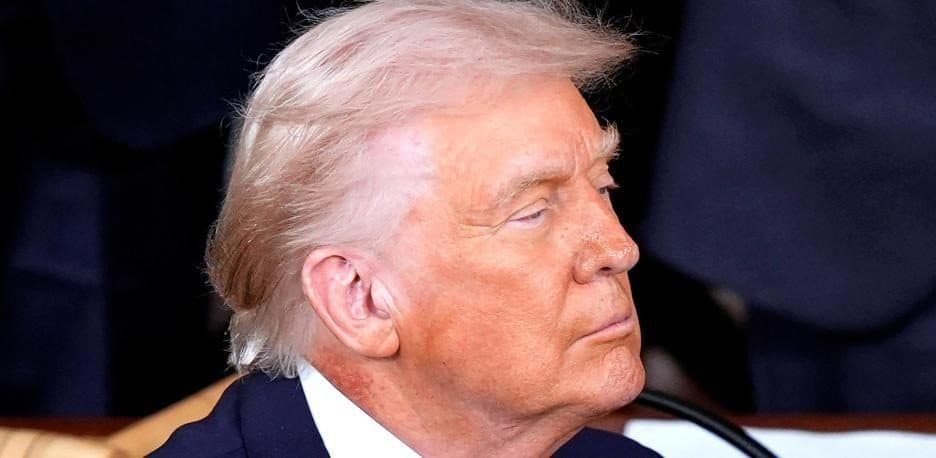 Revelan el misterioso sarpullido de Donald Trump: ¿Qué significa?