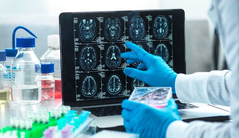 Avance Médico: Japón Aprueba Tratamientos con Células iPS para Parkinson y Más