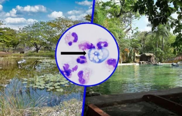 Autoridades sanitarias detectan la ameba "comecerebros" en seis lagos de México