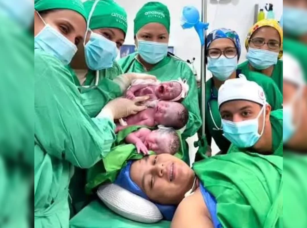 Emotivo adiós en Guasipati: madre de trillizos fallece tras parto