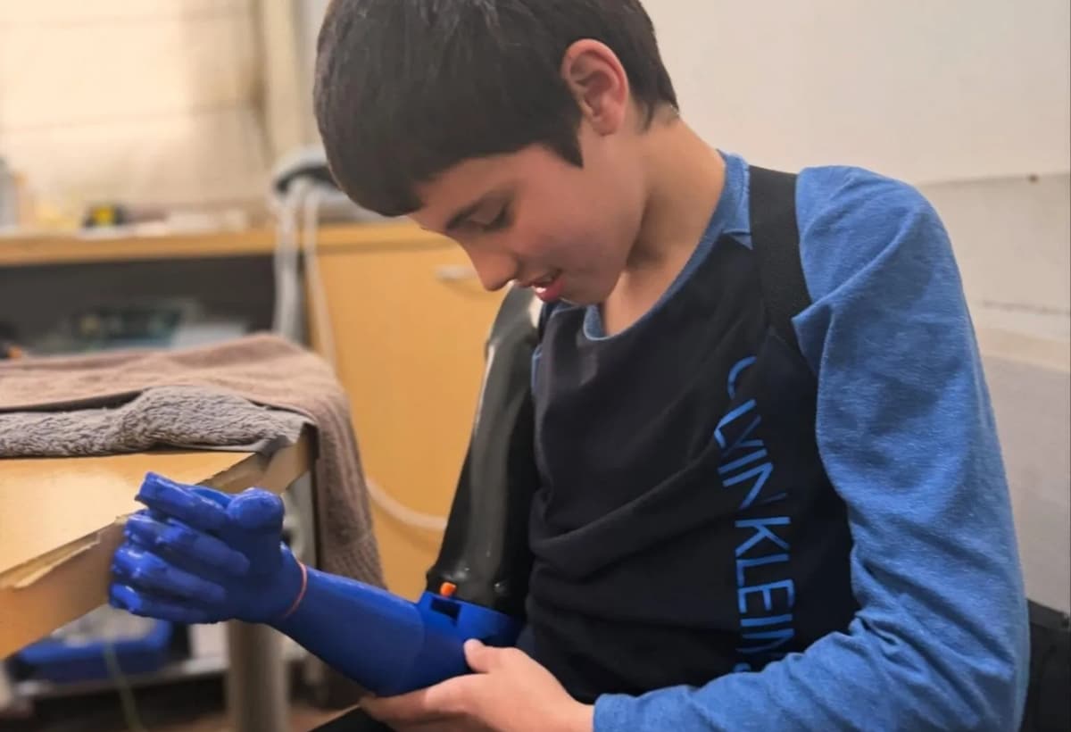 Fundación uruguaya enseña a fabricar prótesis 3D para ayudar a víctimas de los terremotos en Venezuela y Colombia