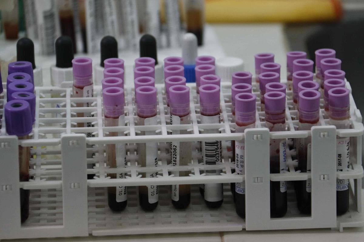 La IA puede ayudar a detectar personas en riesgo de sufrir cáncer