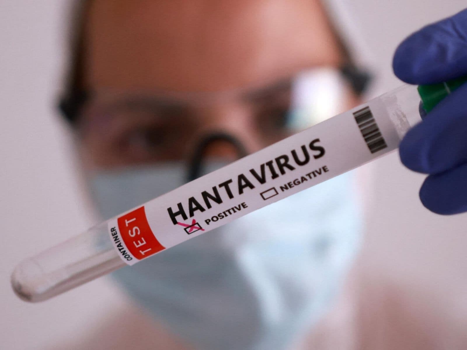 Alerta Sanitaria: Tres Muertes por Hantavirus en Anzoátegui